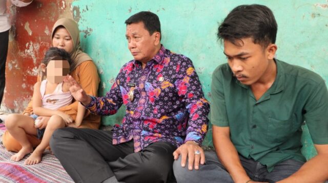 Bupati Tangerang Kunjungi Anak Penderita Kanker Mata di Kronjo
